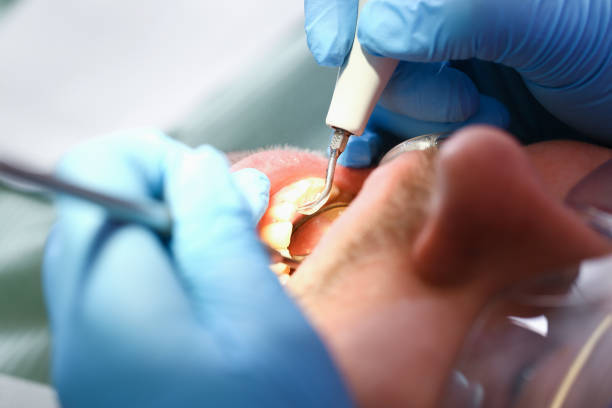 Best Emergency Treatment for Toothache in Vinco, PA